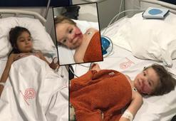 Ankara’da pitbull saldırısına uğrayan 1,5 ve 5 yaşındaki kardeşler yaralandı