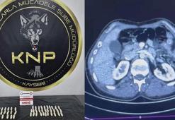 İranlı şüphelilerin midelerinde uyuşturucu tespit edildi; 3 gözaltı