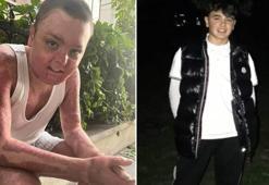 Kağıthane’de kuafördeki yangında tüm vücudu yanan 14 yaşındaki Engin'in tedavisi tamamlandı: Kapı sıkışınca çıkamadım yandım