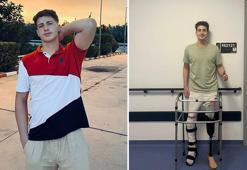 Motosiklet kazasında bacağını kaybeden Berk, protezle ayağa kalktı