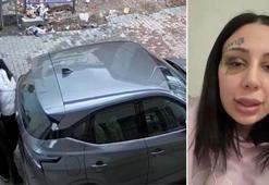 Kağıthane’de eşinin silah çekip darbettiği Yağmur: Hamile kaldım evlendik şiddet başladı