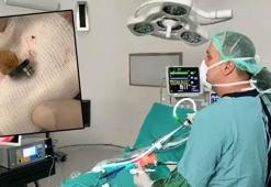 3 mıknatıs yutan 1,5 yaşındaki Faruk, laparoskopi destekli ameliyatla sağlığına kavuştu