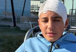 Şakalaştığı okul arkadaşı, taşla Hasan Berat’ı hastanelik etti