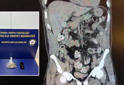 Fas’tan Beşiktaş'a midesinde uyuşturucu getirdi; ameliyatla çıkarıldı