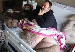 DHA'nın haberi sonrası fil hastası babaya yardım eli