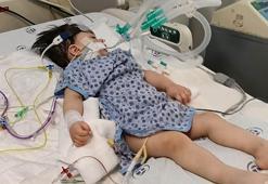Minik Alper’in anestezi sonrası kalbi durdu, entübe edildi; aile suç duyurusunda bulundu