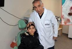 Kaşıntı şikayetiyle hastaneye giden Emirhan'ın burnundan çekirdek ve pipet parçası çıktı