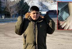 Otizmli öğrenciye darp iddiasına inceleme