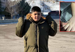 Otizmli öğrenciye darp iddiasına inceleme