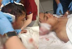 Okul çıkışı sokak köpeklerinin saldırdığı Davut, yaralandı