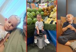2,5 yaşındaki Nikoloz’un beyninden 7 santimetrelik tümör çıkarıldı