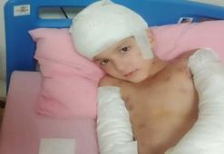 Sokak köpeklerinin saldırısında yaralanan Tunahan'ın ailesine, 5 milyon TL manevi tazminat ödenecek