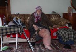Fil hastalığıyla mücadele ederken oturduğu evin yıkılacağını öğrendi; 'Bacağım bu haldeyken nereye gideceğim'