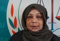 Polis eşi tarafından darbedildiği iddiasıyla şikayetçi oldu