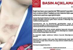 Eyüpsultan'da 3 yaşındaki çocuğa şiddet iddiası