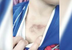 Kreşte çocuğa şiddet soruşturması; 1 şüpheli tutuklandı