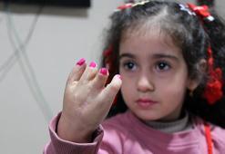 10 ameliyat geçiren yapışık parmak Elif Lina’nın ailesinden çağrı