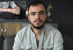 Başına metal parça saplanan işçi, 17,9 milyon TL tazminat kazandı