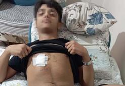 Eski sevgilisiyle yazıştığı akranı ve onun arkadaşları tarafından dövülüp, bıçaklandı