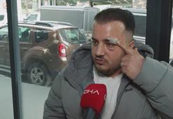 Eyüpsultan’da ‘yol verme’ kavgasında darbettiği sürücüyü tanımazlıktan geldi