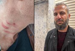 Aile hekimini darbeden müezzin, savcılığın itirazıyla yeniden gözaltına alınıp tutuklandı