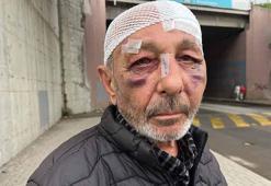 Önce çakmak istediler ardından sokak ortasında darbettiler