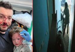 Baba ile 14 aylık bebeğinin darbedildiği olayda şüphelilerin ifadesi ortaya çıktı