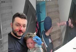 İkra bebek ile babasının darbedildiği olaya ilişkin yeni görüntüler ortaya çıktı