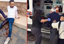 Tartıştığı butik sahibine pompalı tüfekle saldırdı: 3 yaralı