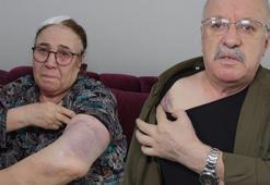 Esenyurt'ta bir yıldır tehdit ettiği çifti sopayla darbetti