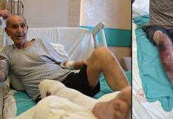 Tıkalı lavaboyu açmaya çalıştı, kimyasal yanıkla hastanelik oldu