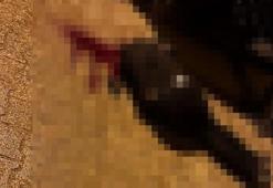 Sokakta yürürken tabanca ile başından vuruldu