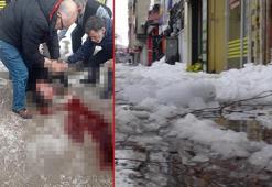 Çatıdan üzerine kar ve buz kütlesi düşen kişi ağır yaralandı