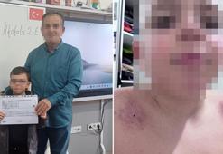 Oğlunu darbettiğini iddia ettiği öğretmenden şikayetçi oldu