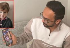 Pitbull saldırısında yaralanan kardeşlerin babası: Oğlumun yüzündeki yara kalıcı olacak gibi