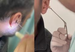 Kulağına gizlediği uyuşturucuyla yakalandı