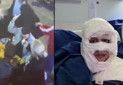 Kadıköy'de üzerine kolonya döktüğü kadını yakan sanık hakim karşısında