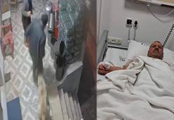 Köpek saldırısında parmağı koptu; o anlar kamerada