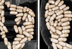 2 şüphelinin midesinden 127 kapsül uyuşturucu çıktı