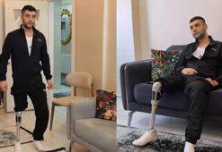 Akın motosiklet kazasında bacağını kaybetti, hayırseverler 450 bin liralık protezle yürümesini sağladı