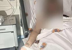 Konuşma bahanesiyle çağırdığı eski sevgilisini boğmaya çalışıp, 10 yerinden bıçakladı