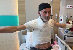 Güneş enerji sistemindeki arızayı tamir ederken üzerine dökülen sıcak su vücudunu yaktı