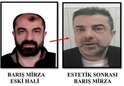 Cinayette azmettirmekten aranan şüpheli, ameliyatla yüzünü değiştirmiş