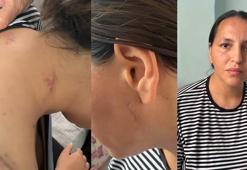 17 bıçak darbesiyle yaralanan Havva, tutuklanan eşinin en ağır cezayı almasını istedi