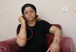 16 yıl dini nikahla birlikte yaşadığı kişi tarafından 30 yerinden bıçaklandı