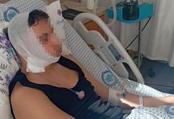 Lise öğrencilerinin darp davası: Çenesi nasıl kırıldı anlam veremedik