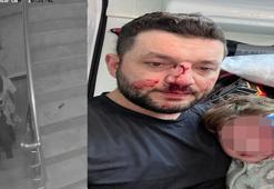 Kucağında bebeği olan babayı darbeden şüpheli adli kontrolle tahliye edildi