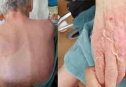 Huzurevinde ölüme verilen taksitli para cezasının gerekçesi: Gerekli tedbirler alınmamış