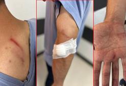 İlaç raporu tartışmasında tıbbi sekreteri darbetti