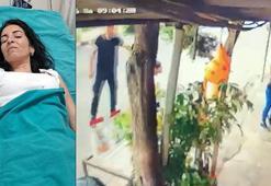 Boşanma aşamasındaki 16 yıllık eşi tarafından bıçaklanan Çiğdem, yaşam mücadelesi veriyor